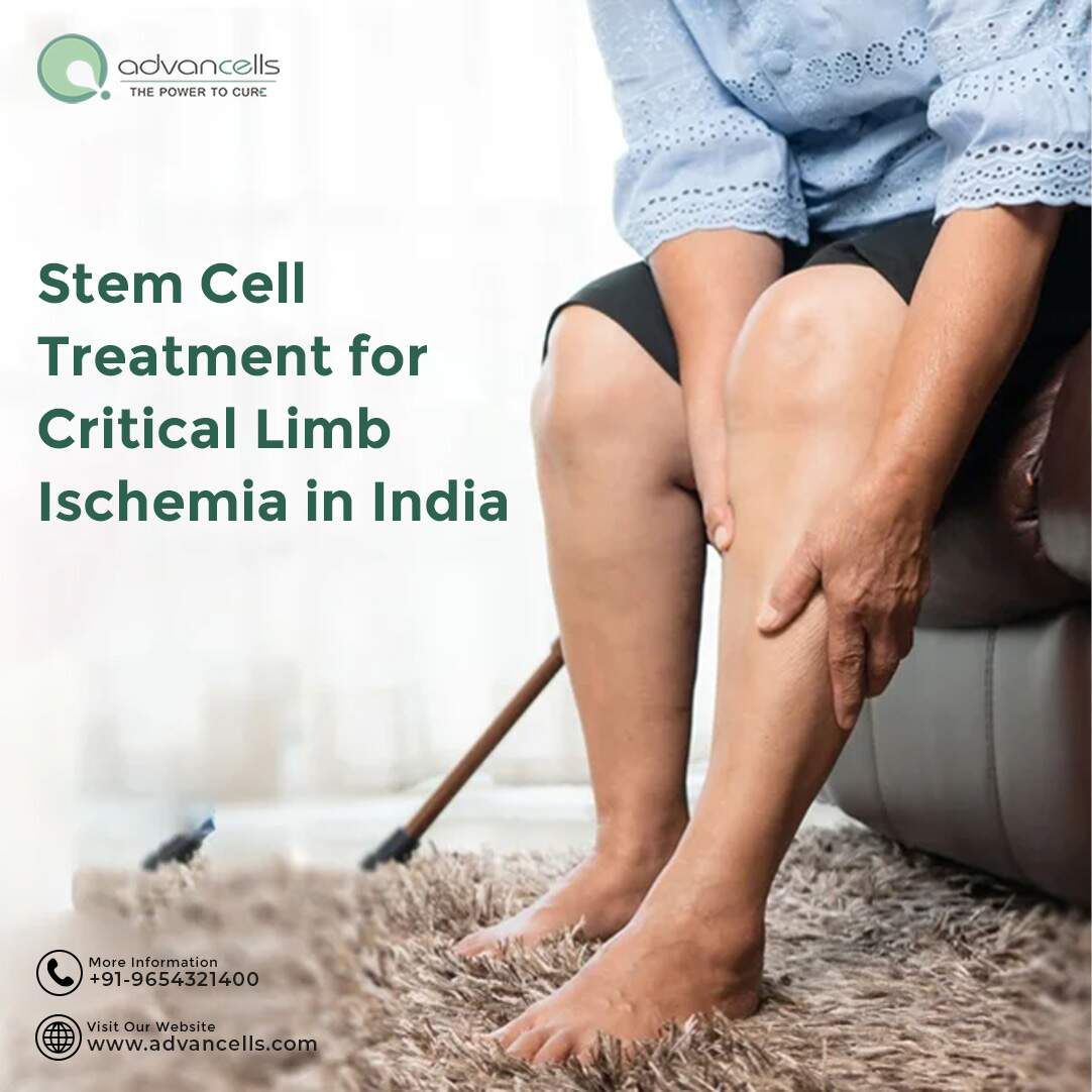 Critical Limb Ischemia Treatment in India: Options for Hope and Healing