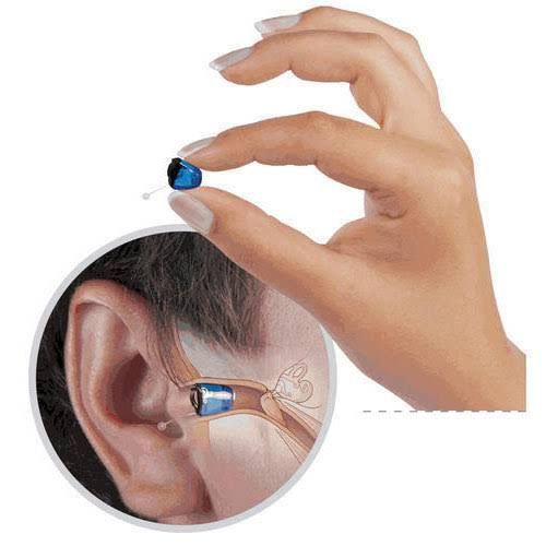 Buy Invisible Hearing Aids in Kolkata – Hazra Hearing Aid Centre