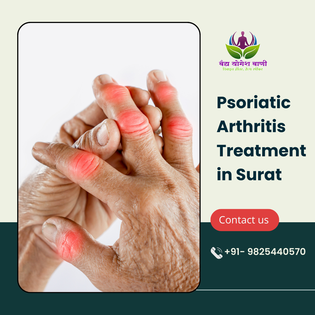 What is the role of dermatologists in psoriatic arthritis treatment in Surat 
