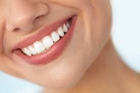 How Much Does Dental Bonding Cost?