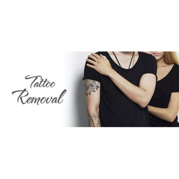 Tattoo Removal Center in Bangalore-Tattoo Removal Cream