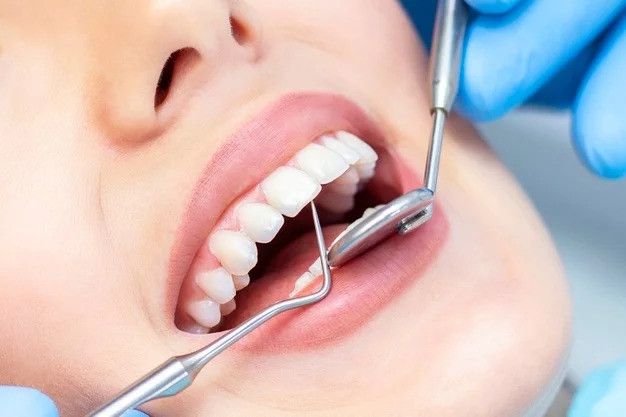 Importance of Regular Checkups: What Preventive Dentistry Really Means
