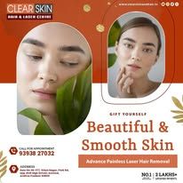 Best Birthmark removal laser treatment in india