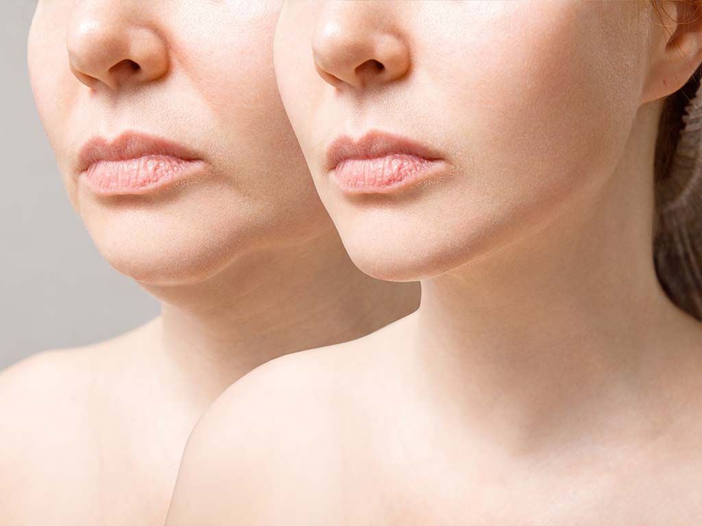 How Do You Know If You’re a Good Candidate for Blepharoplasty?