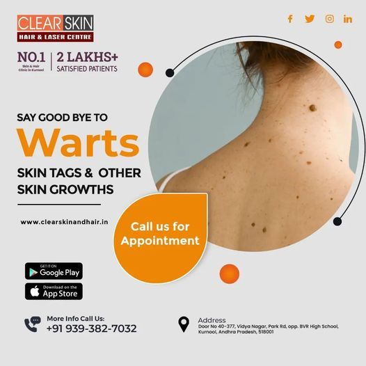 best laser treatment clinic in india