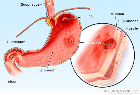 Esophago Gastro Duodenoscopy