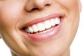 Professional Teeth Whitening Cost