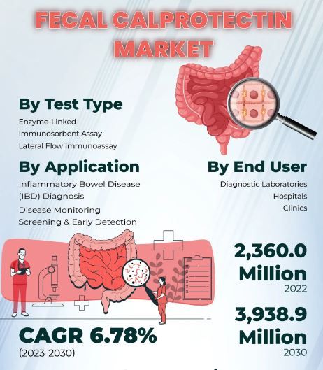 Fecal Calprotectin Test Market Size, Share, Types, Products