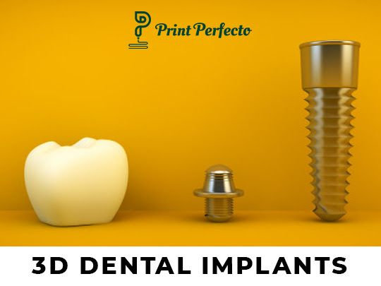 3D dental printing in Madurai - Print Perfecto 3D