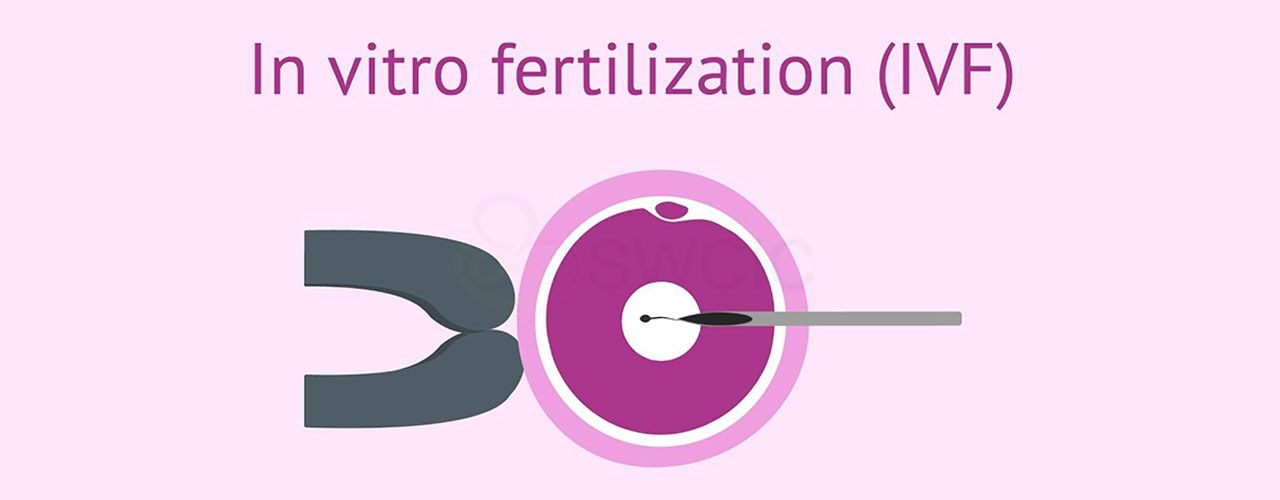  IVF Cost in India