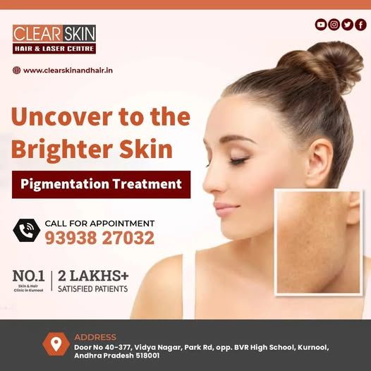 Best Acne Scar Laser Treatment  In India