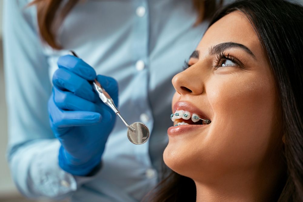 Straight Teeth in Record Time: Arlington’s Fast Braces Revolution