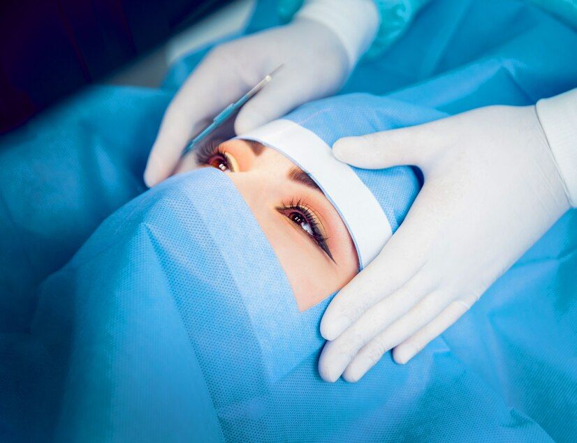 Lasik Laser Eye Surgery Cost