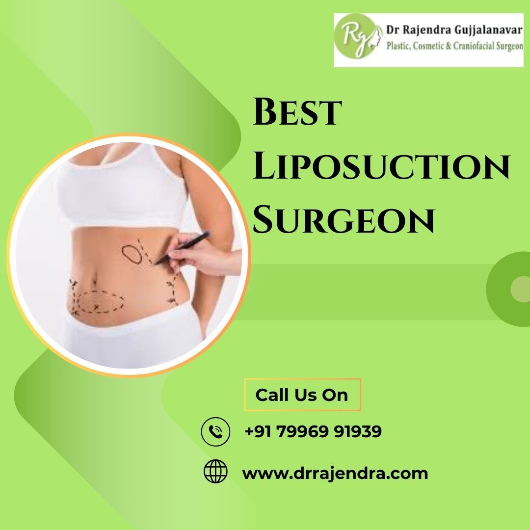 Choosing the Best Surgeon for Liposuction: Key Factors to Consider