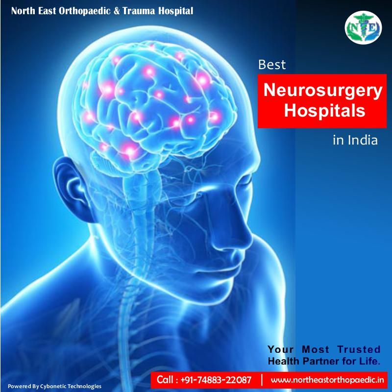 Best Neuro Hospital in Patna| Best neuro doctor in Patna