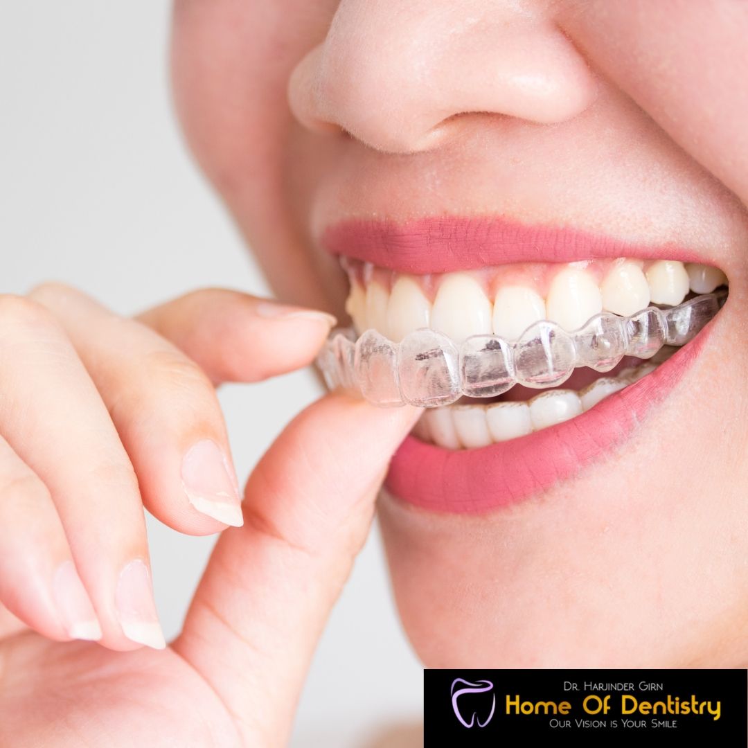Looking for Invisalign treatment in Mississauga?