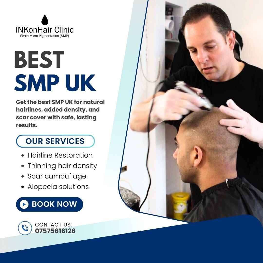 Best SMP UK for Hair Loss Solutions