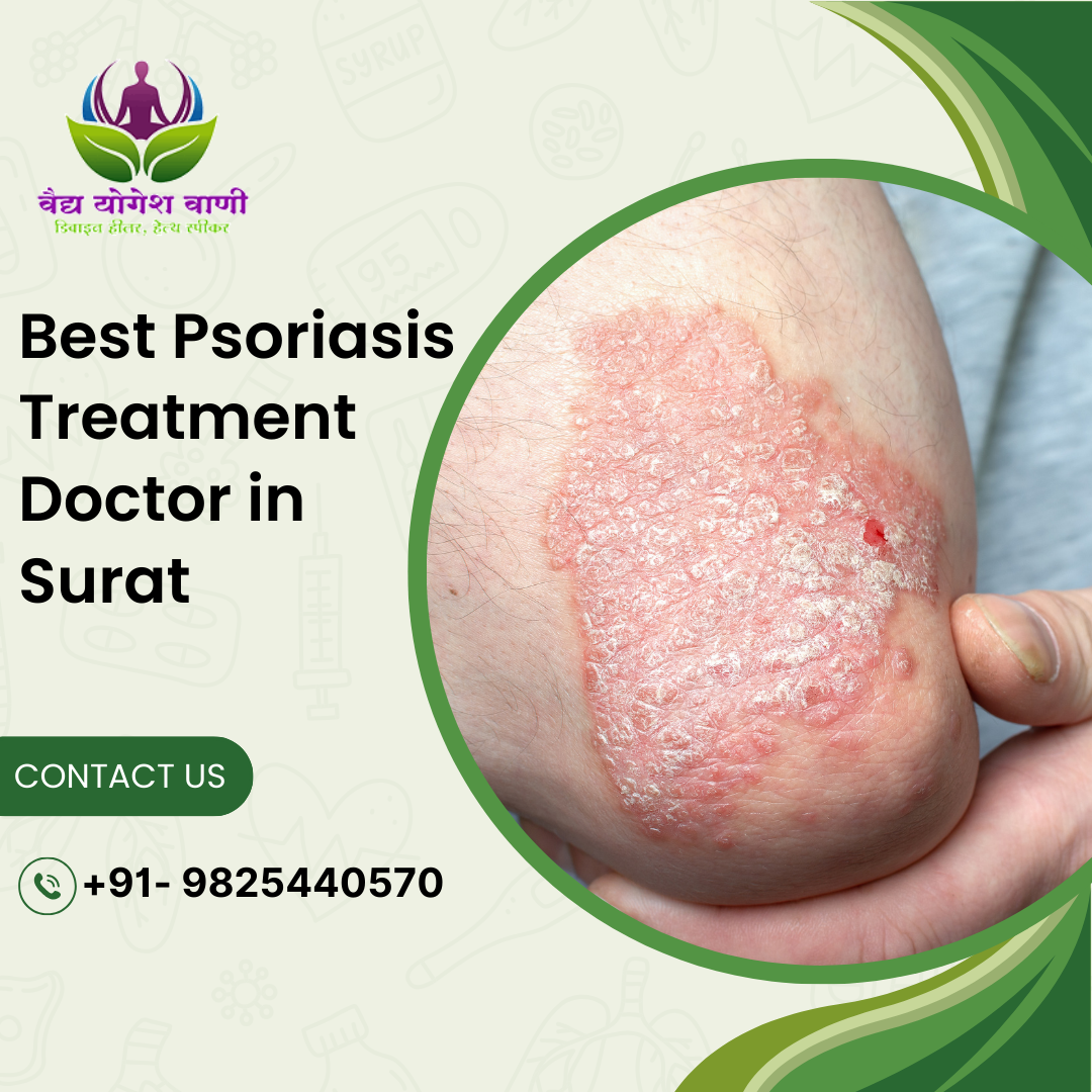 Best Psoriasis Treatment Doctor in Surat for Clear, Healthy Skin