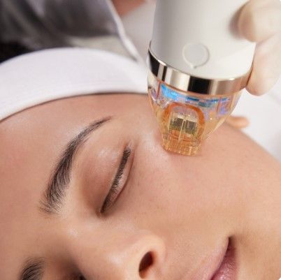 Microneedling Treatment in Houston At Lean-Ish