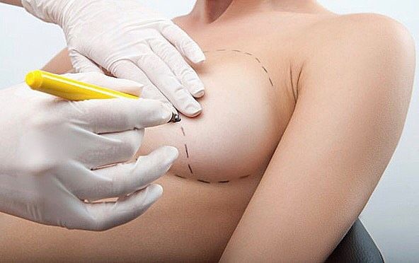 Breast Lift With Augmentation Treatment in South Africa