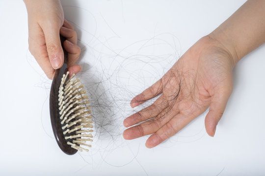 Best Trichologist in Mumbai for Hair Loss & Scalp Treatments – Revital Trichology