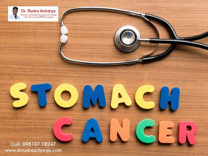 Stomach Cancer: Get The Right Treatment