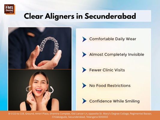 Clear Aligners in Secunderabad - FMS Dental