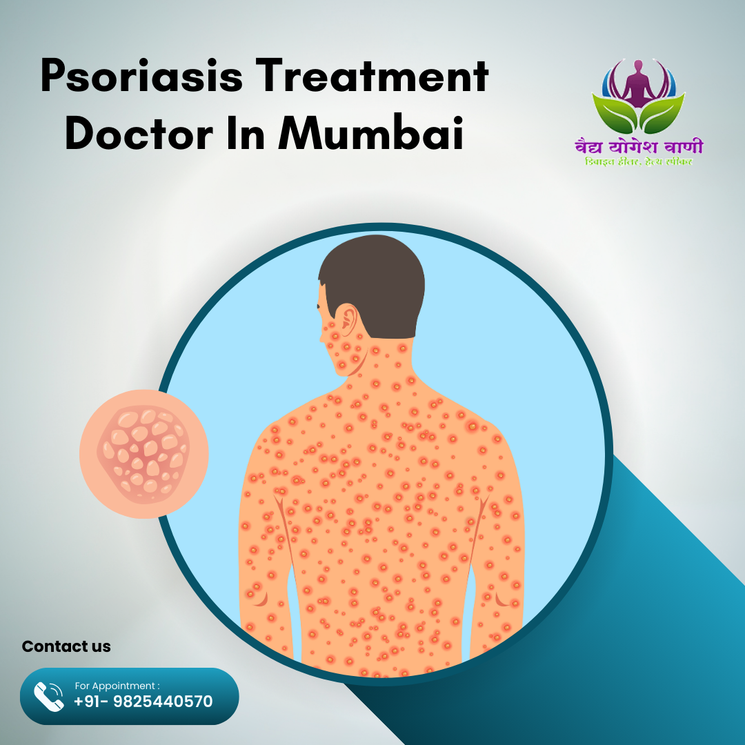Experienced Psoriasis Doctor in Mumbai – Trusted Care