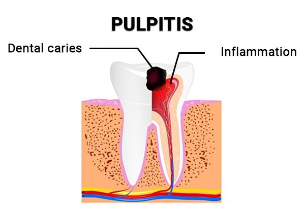 Emergency Dentists in Stamford, CT