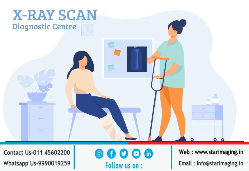 X-Ray cost near me in Delhi NCR - Star Imaging & Path Lab