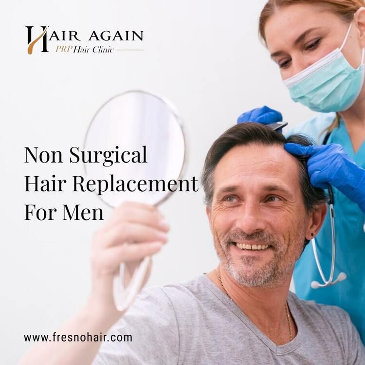  Non Surgical Hair Replacement For Men in Fresno, CA