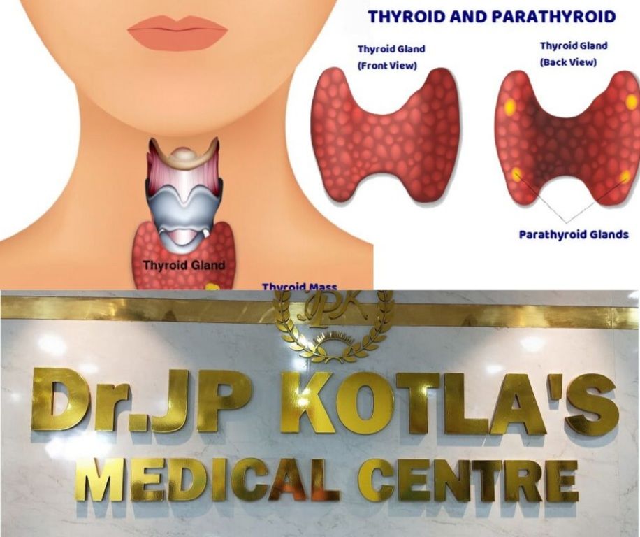 Best Thyroid Center in Himayat Nagar | Dr JP Kotla Medical Center
