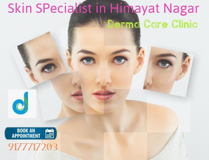 Skin Specialist in Himayat Nagar  | Acne Scar Treatment in Himayat Nagar