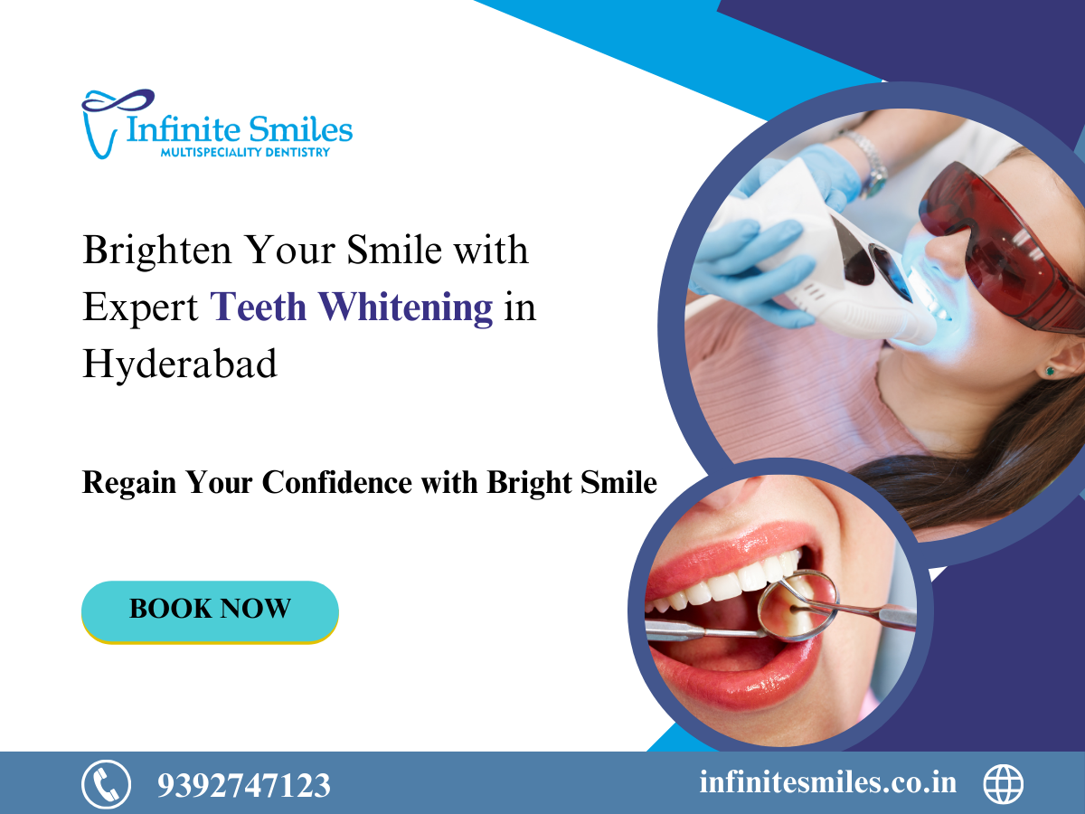 Achieve a Radiant Smile with Teeth Whitening in Hyderabad