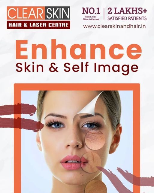 skin doctor best in kurnool