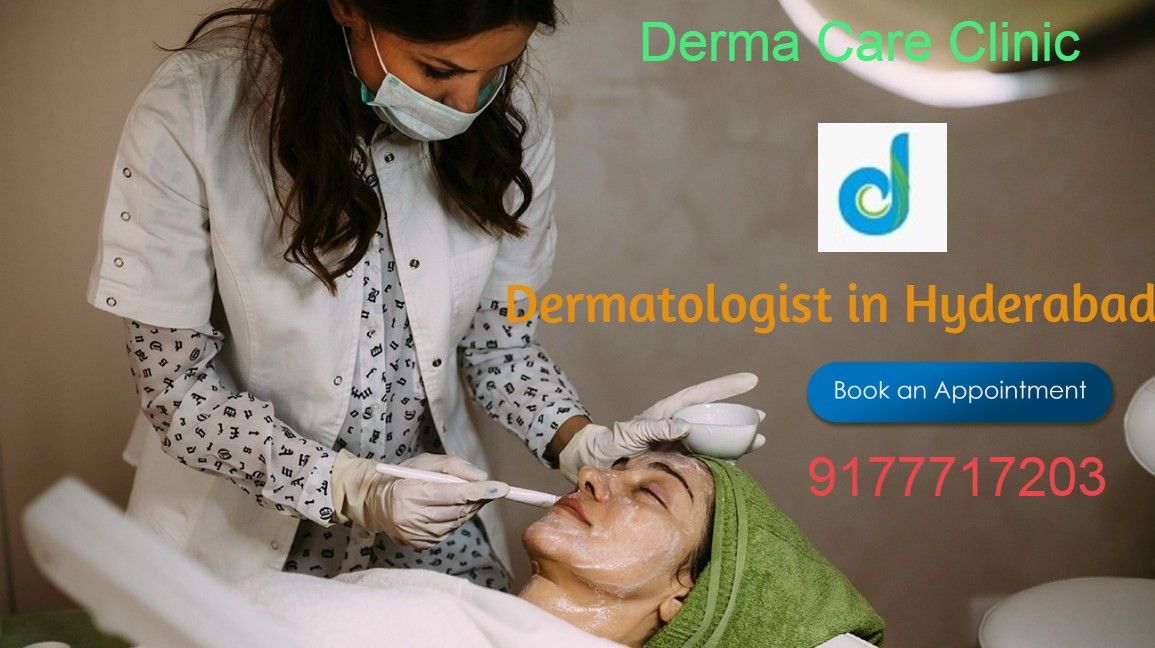 Best Dermatologist in Hyderabad | Acne Treatment in Himayat Nagar