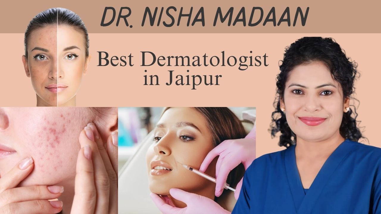 How to find the Best Dermatologist for Acne, Filler, & Peel Treatment in Jaipur?