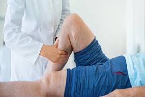 varicose vein treatment south shore, Long Island