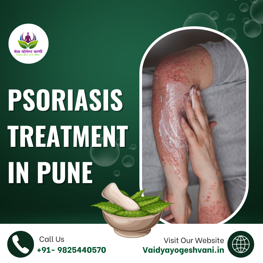 Where can I get the best psoriasis treatment in Pune