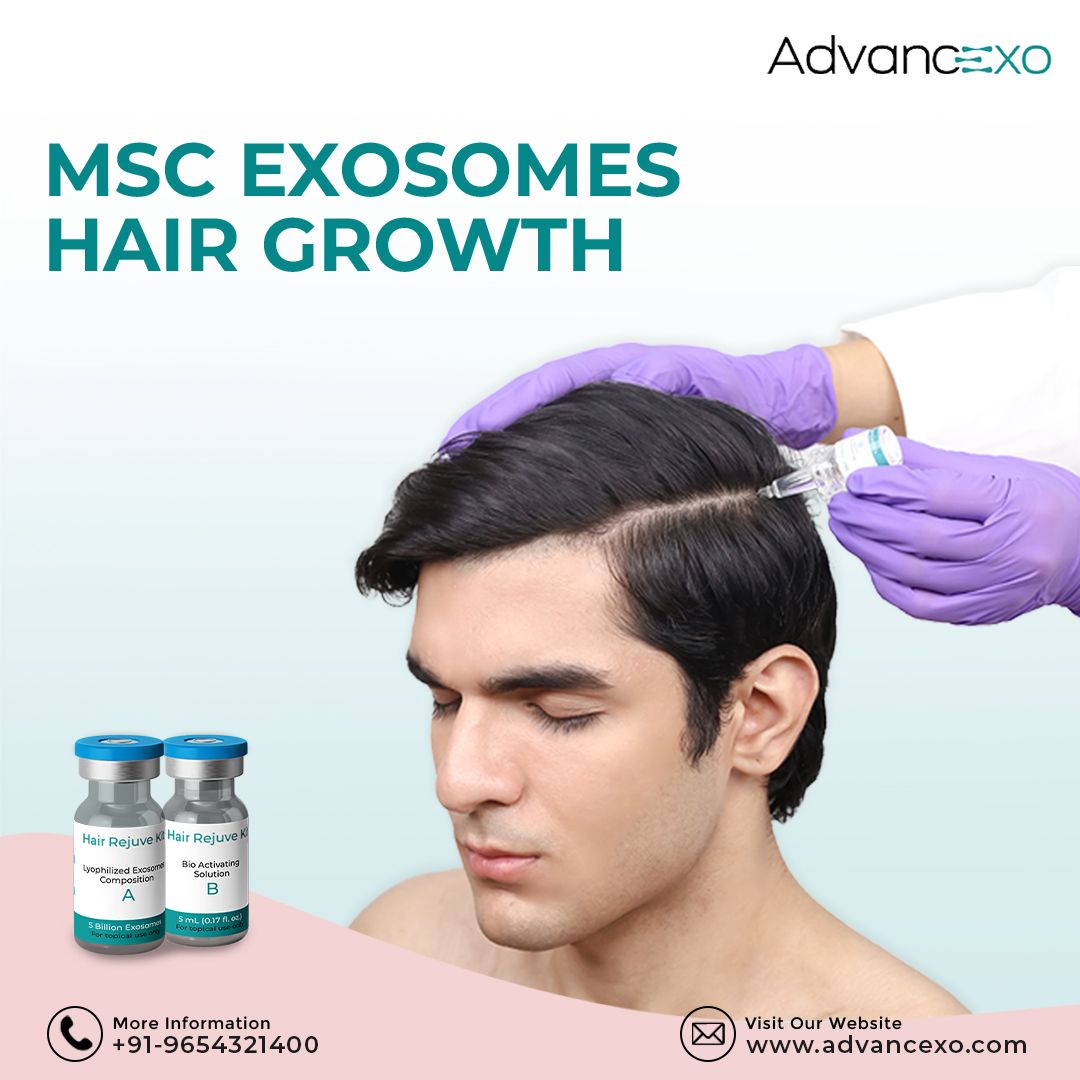 MSC Exosomes for Hair Growth: Advanced Solutions by Advancexo