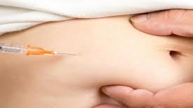 Fat Dissolving Injections in Riyadh