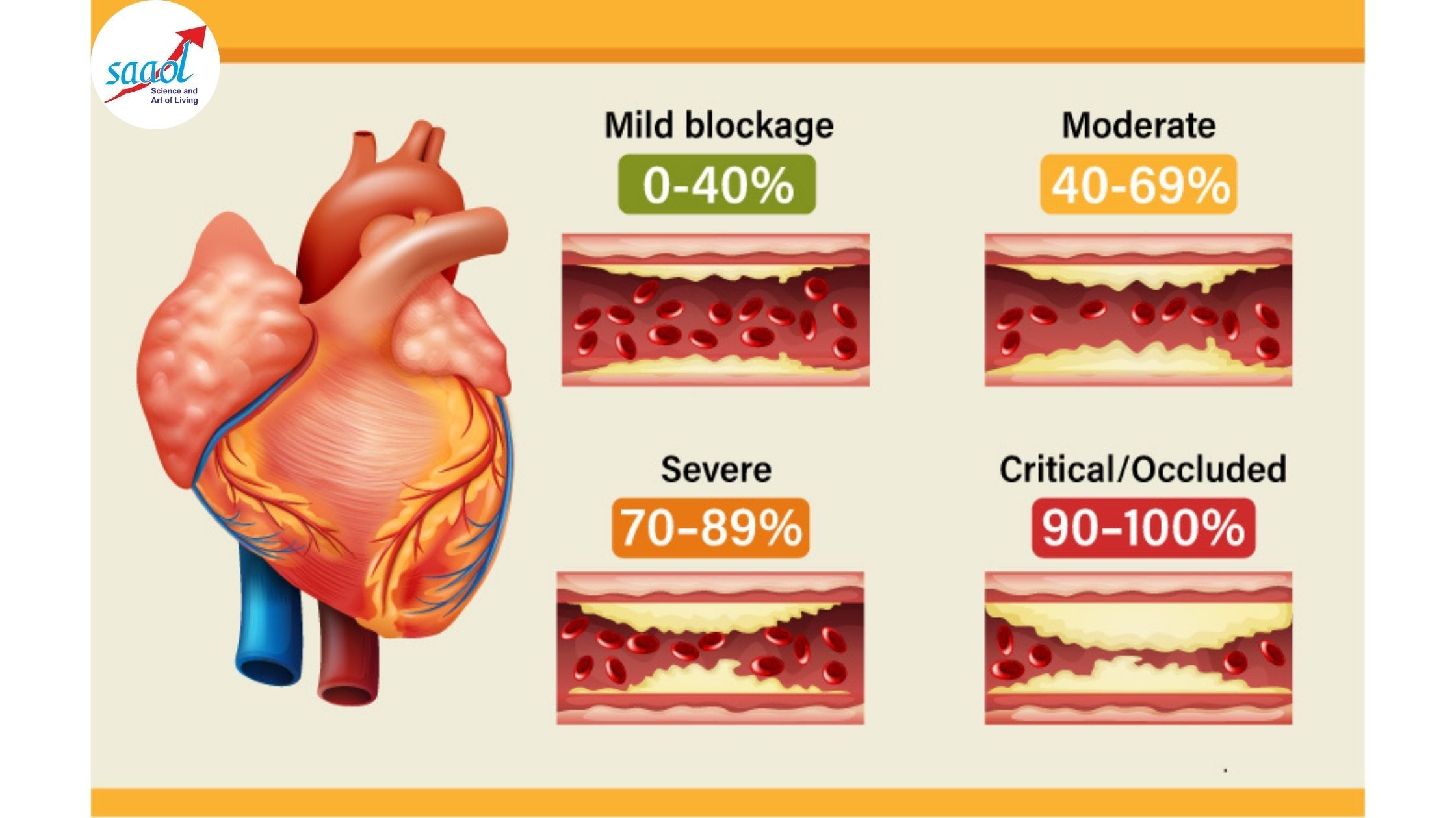 Heart Attack vs Heart Failure: Causes, Symptoms & EECP Treatment