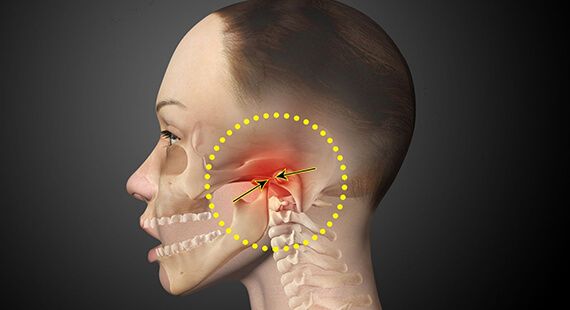 Management of TMJ in Delhi | TMJ Joint Surgery | Oral and Maxillofacial Surgeon