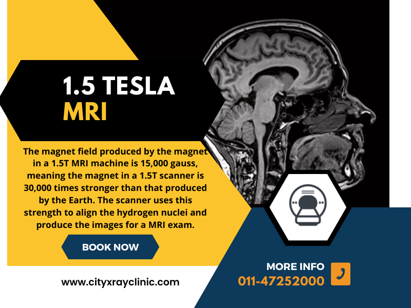 MRI 1.5 Tesla Price Know Cost Clearly Before You Book
