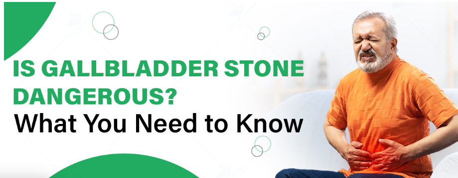 Is Gallbladder Stone Dangerous? What You Need to Know