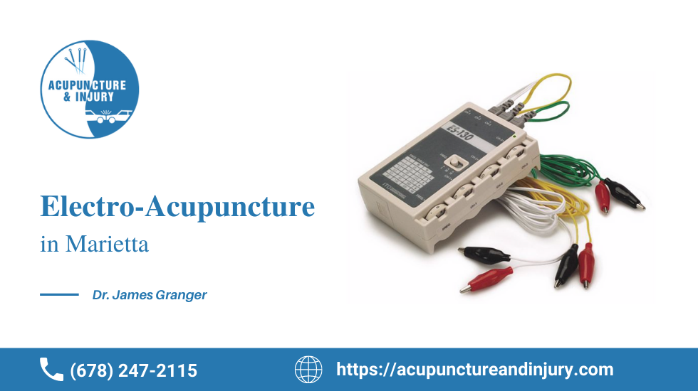 Best Electro- Acupuncture service provider in Atlanta GA