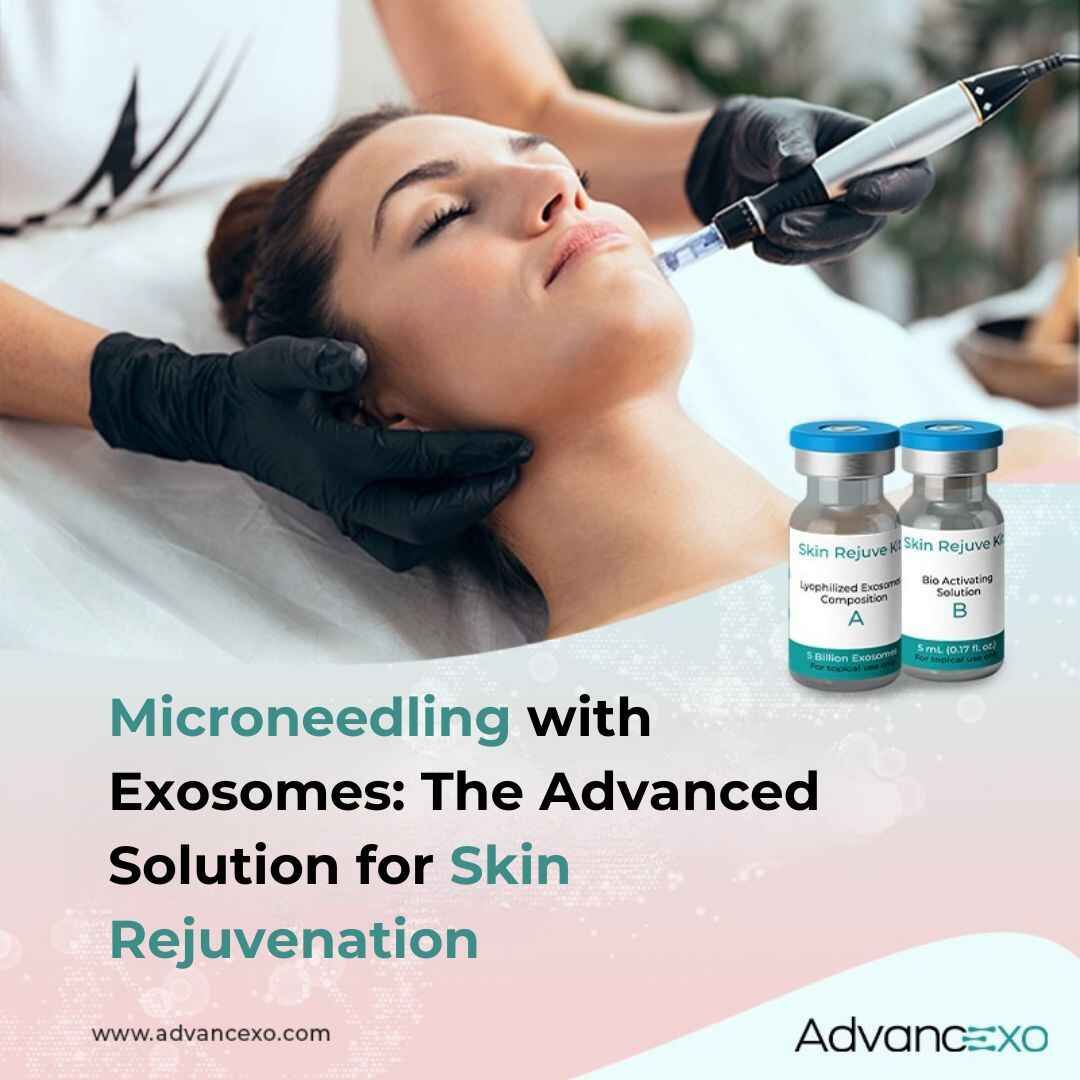 Microneedling with Exosomes: The Advanced Solution for Skin Rejuvenation