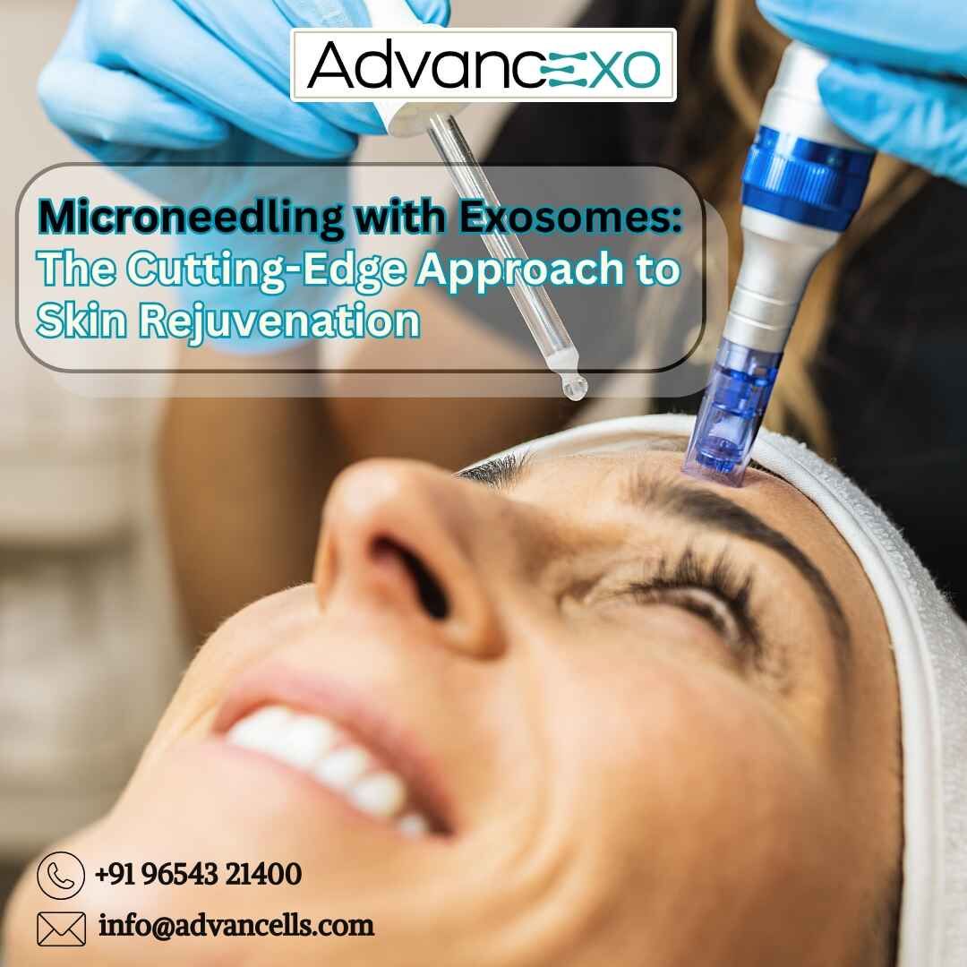 Microneedling with Exosomes: The Cutting-Edge Approach to Skin Rejuvenation