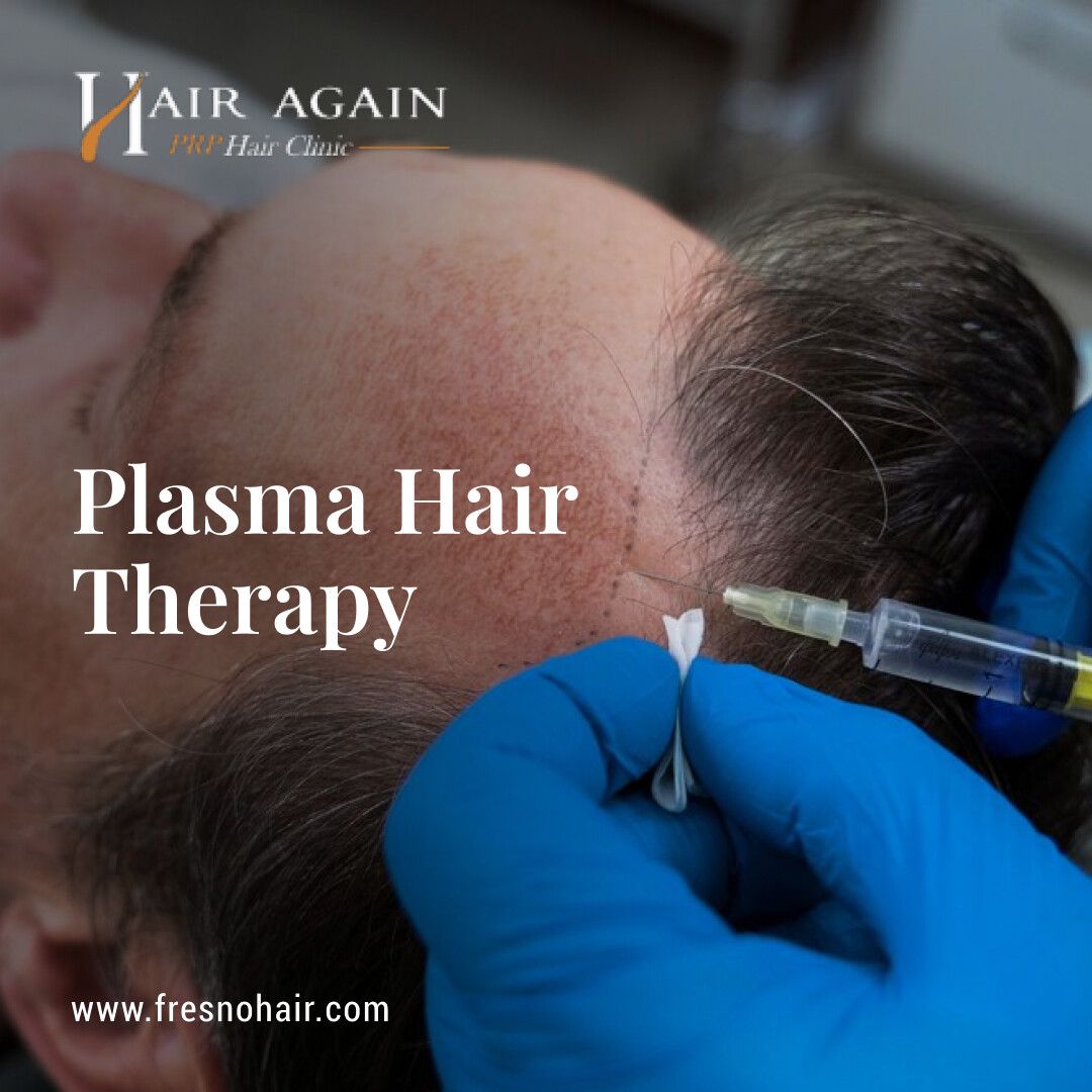 Platelet Rich Plasma Hair Therapy