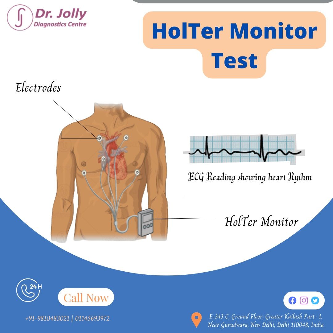Best Holter Monitor Test Cost Near Me Greater Kailash Delhi